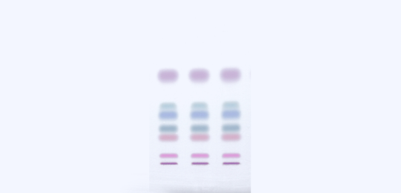 TLC (Thin Layer Chromatography)